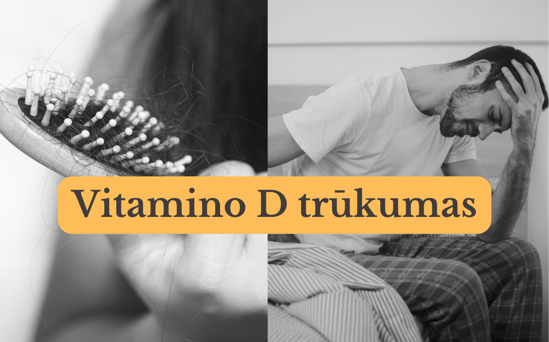 Vitamino D trūkumas